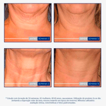 Creme-Antissinais-Neostrata Skin-Active-Triple-Firming-80g