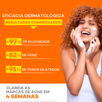 Gel-de-Limpeza-Actine-Peles-Oleosas-e-Acneicas-60g