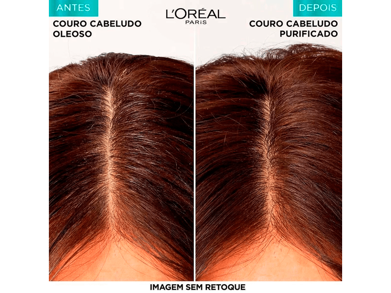 Shampoo-Elseve-Pure-Hialuronico-200ml