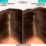 Shampoo-Micelar-Antioleosidade-Elseve-Pure-300ml