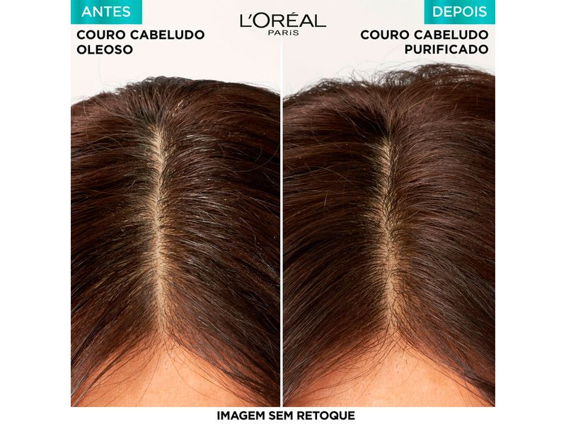 Shampoo-Micelar-Antioleosidade-Elseve-Pure-300ml
