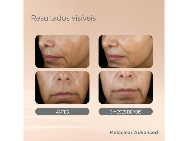 Sérum Facial Clareador Isdin Melaclear Advanced 30ml