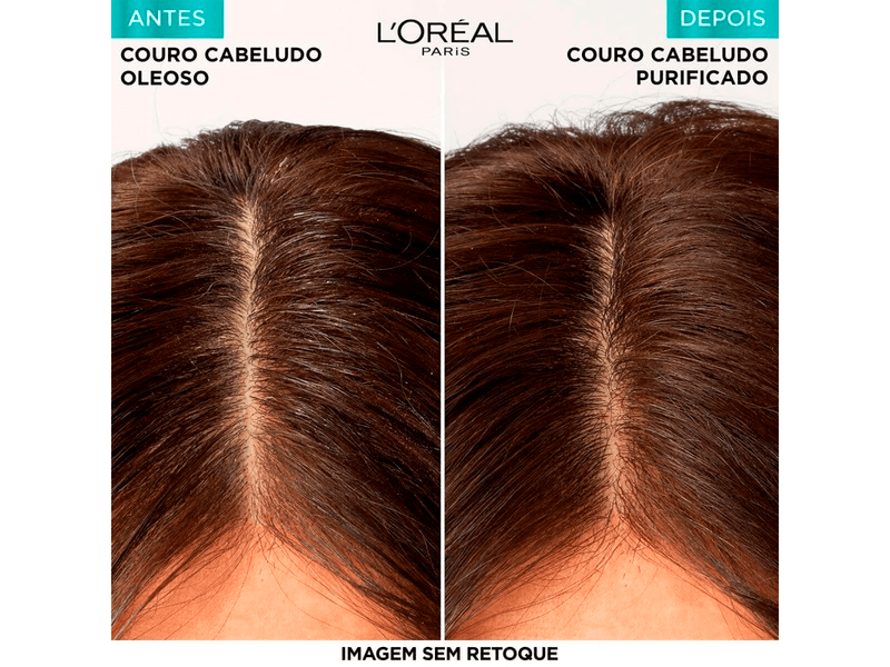 Kit-Elseve-Pure-Hialuronico-Shampoo-375ml---Condicionador-170ml