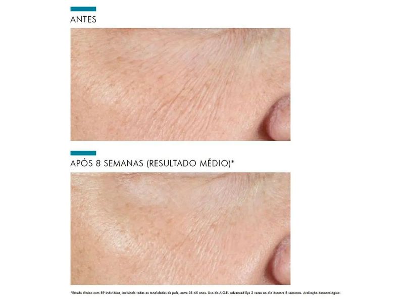 creme-tratamento-anti-idade-para-contorno-dos-olhos-skinceuticals-age-advanced-eye-15ml-farmacia-online-drogal