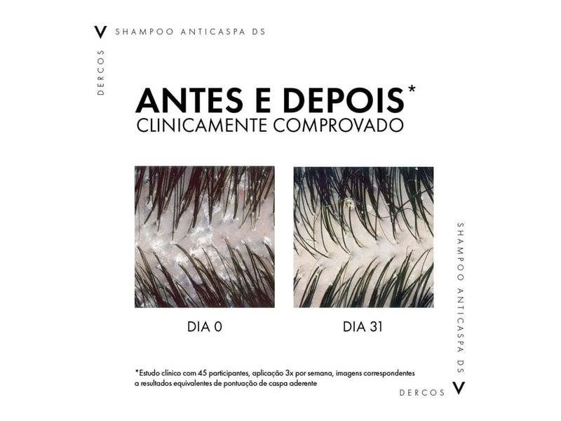 shampoo-anticaspa-ds-vichy-dercos-cabelos-normais-a-oleosos-300g-farmacia-online-drogal