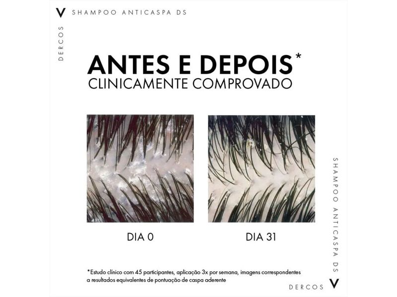 refil-shampoo-anticaspa-vichy-dercos-cabelos-secos-200g-farmacia-online-drogal