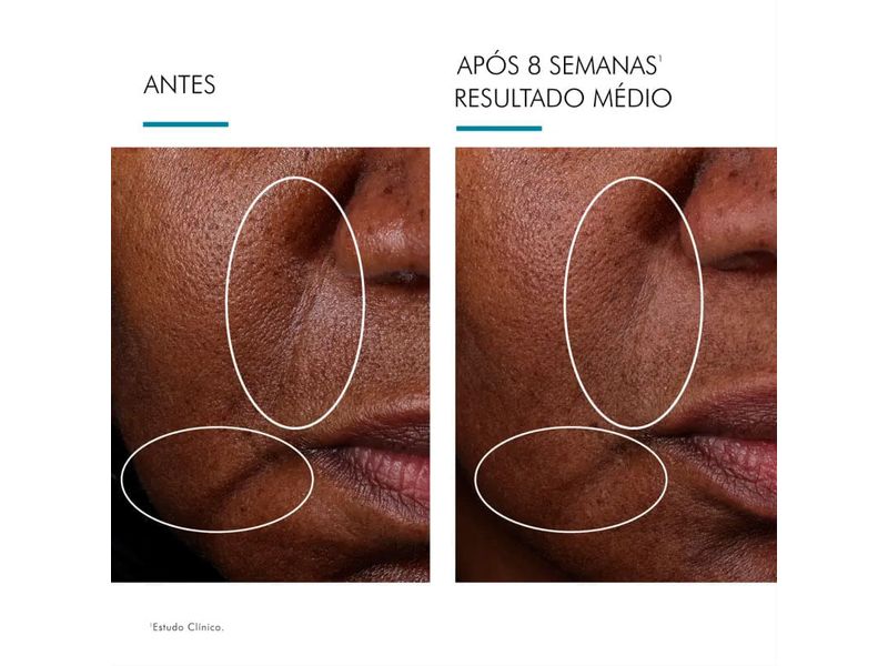 serum-booster-renovador-celular-skinceuticals-cell-cycle-catalyst-30ml-farmacia-online-drogal