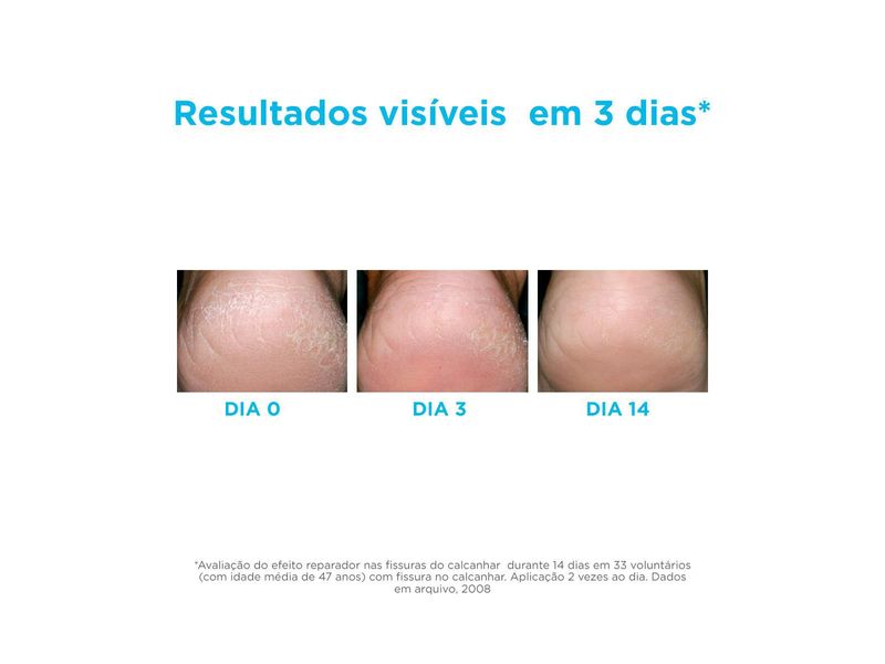 gel-oil-hidratante-isdin-ureadin-podos-75ml-farmacia-online-drogal