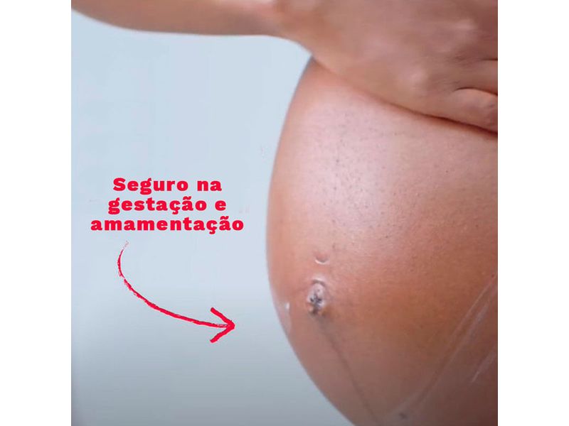 creme-para-prevencao-de-estrias-mustela-acao-3-em-1-250ml-farmacia-online-drogal