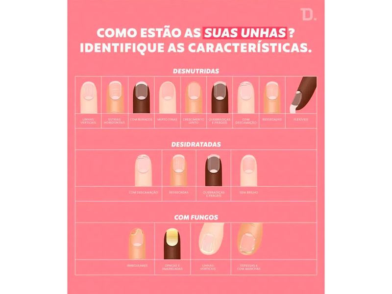 base-antifungica-dailus-livrai-me-dos-fungos-8ml-farmacia-online-drogal
