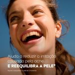 hidratante-facial-nivea-acne-control-50g-farmacia-online-drogal