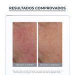 creme-hidratante-facial-eucerin-anti-redness-fps25-50ml-farmacia-online-drogal