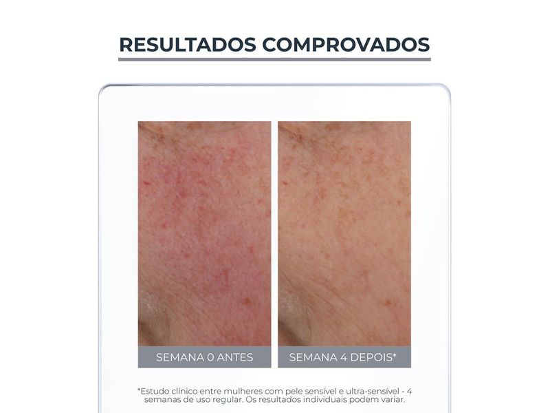 creme-hidratante-facial-eucerin-anti-redness-fps25-50ml-farmacia-online-drogal