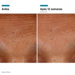 serum-facial-skinceuticals-ha-intensifier-multi-glycan-30ml-farnacia-online-drogal