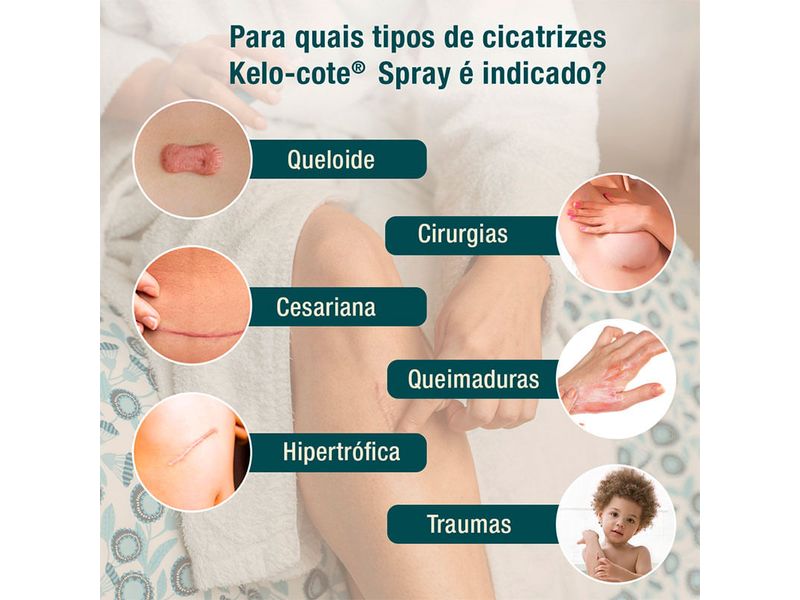 004-gel-hidratante-kelo-cote-spray-100ml-farmacia-online-drogal