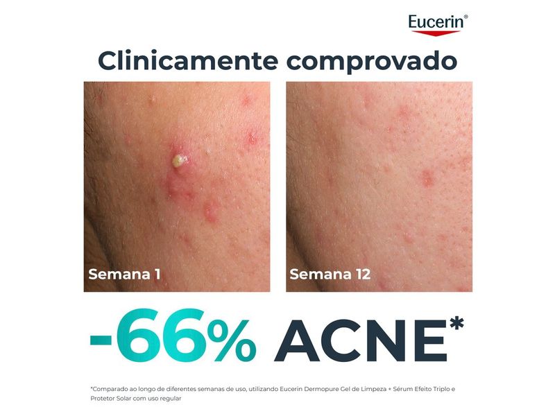 002-serum-facial-eucerin-dermopure-oil-control-efeito-triplo-40ml-farmacia-drogal-online