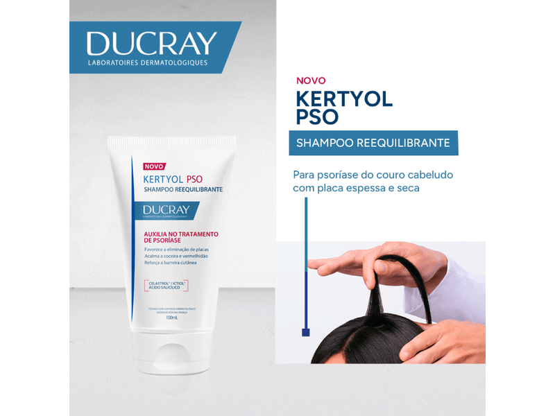 002-shampoo-para-psoriase-do-couro-cabeludo-ducray-kertyol-pso-100ml-farmacia-drogal-online