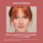 008-protetor-solar-facial-isdin-fotoultra-redness-fps50-50ml-farmacia-online-drogal