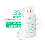 003-sabonete-liquido-corporal-dove-acne-control-547ml-farmacia-drogal