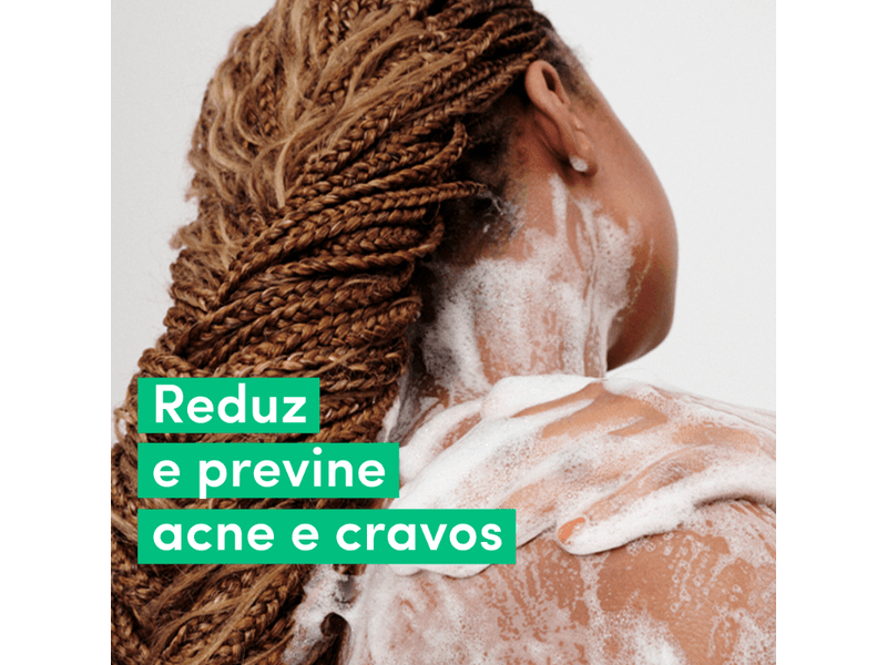 005-sabonete-liquido-corporal-dove-acne-control-547ml-farmacia-drogal