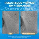 005-serum-reparador-facial-3-em-1-nivea-q10-antissinais-colageno-expert-30ml-farmacia-online-drogal