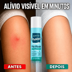 003-pos-picada-above-protect-alivio-imediato-50ml-farmacia-online-drogal